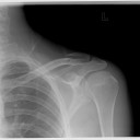 Foto del perfil de Clavicula